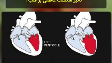 تصویر از از نظر پزشکی قلب شکسته تفاوتی با حمله قلبی ندارد